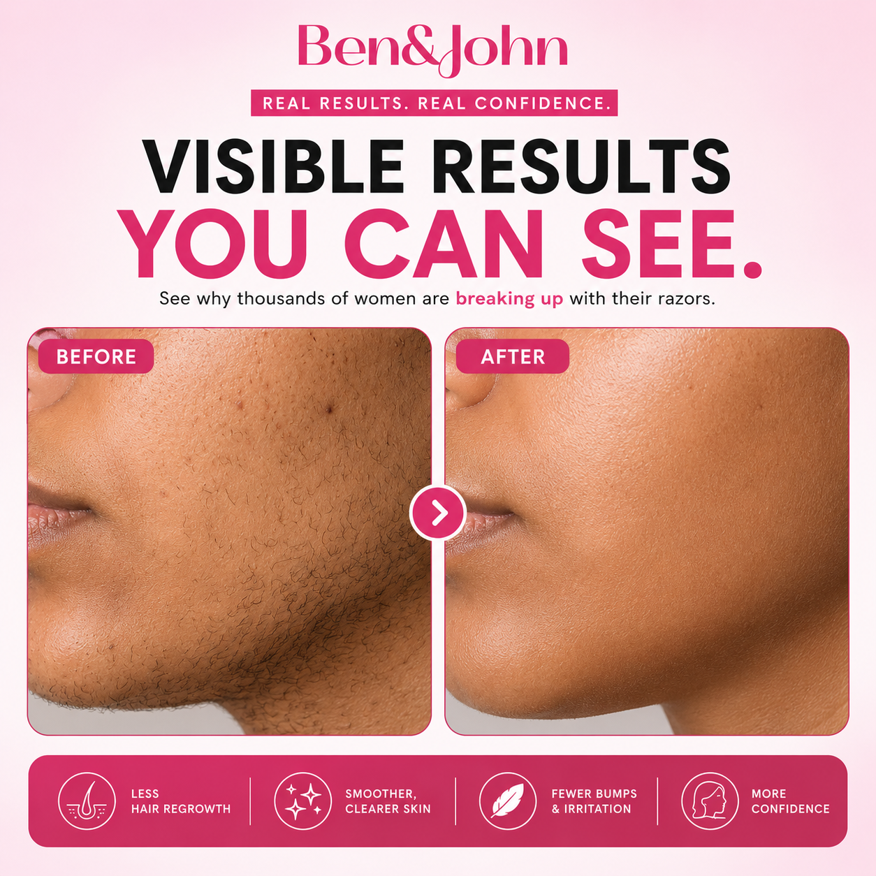Before and after using Ben&John Cyperus Rotundus Oil